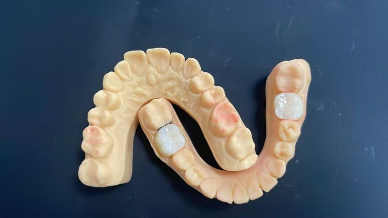 Какъв е ръбът на рамото?