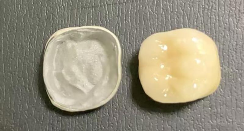 WM DENTAL LAB – Водеща китайска дентална лаборатория