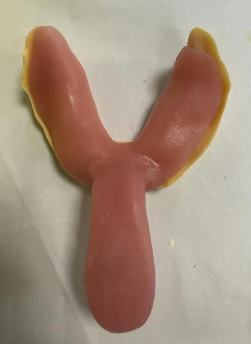 Неща, които не знаехте за персонализираните зъболекарски тави