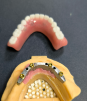 Локатор и дентална лента